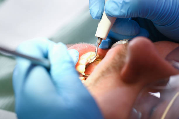 Best Pediatric Emergency Dentist in Rancho San Diego, CA